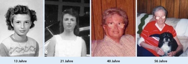 ¿Que es el Síndrome de Werner? - Campus UMEC